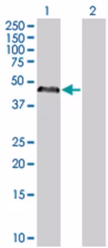 Prkar1a 293t cell transient overexp ression lysate (denatured) 100 µl