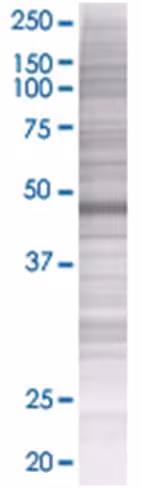 Prkar1b 293t cell transient overexp ression lysate (denatured) 100 µl