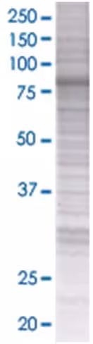 Prkcd 293t cell transient overexpre ssion lysate (denatured) 100 µl