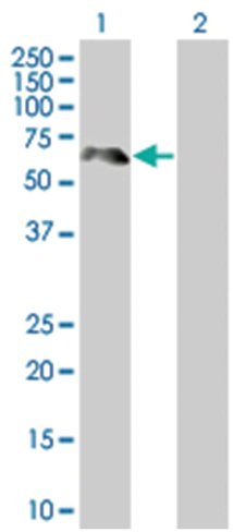 Prkcsh 293t cell transient overexpr ession lysate (denatured) 100 µl
