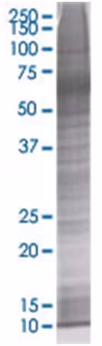Prm1 293t cell transient overexpres sion lysate (denatured) 100 µl