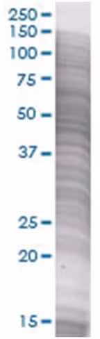Proc 293t cell transient overexpres sion lysate (denatured) 100 µl