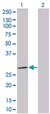 Prss2 293t cell transient overexpre ssion lysate (denatured) 100 µl