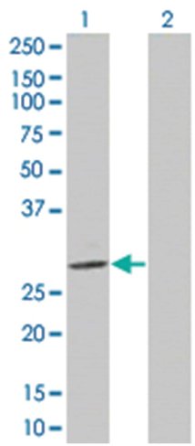 Prss2 293t cell transient overexpre ssion lysate (denatured) 100 µl