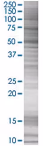 Psmd4 293t cell transient overexpre ssion lysate (denatured) 100 µl