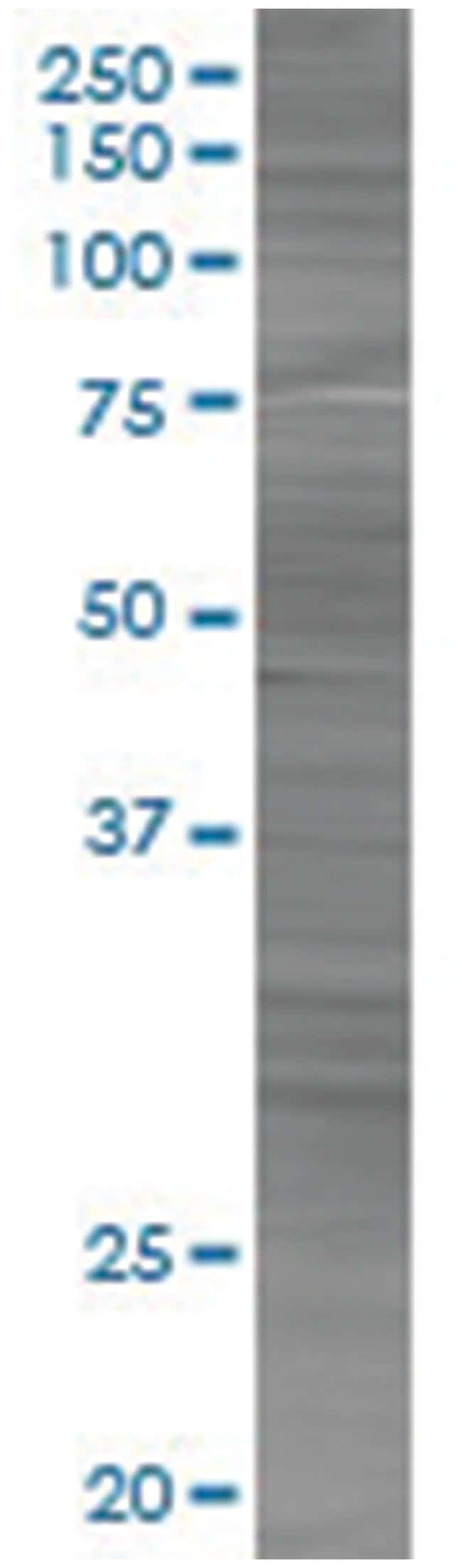 Psme2 293t cell transient overexpre ssion lysate (denatured) 100 µl