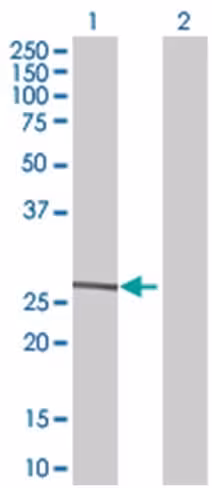 Psph 293t cell transient overexpres sion lysate (denatured) 100 µl