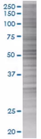 Pten 293t cell transient overexpres sion lysate (denatured) 100 µl
