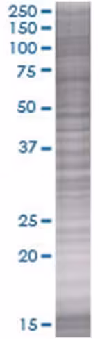 Ptgdr 293t cell transient overexpre ssion lysate (denatured) 100 µl