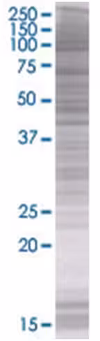 Ptger3 293t cell transient overexpr ession lysate (denatured) 100 µl