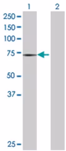Ptgs1 293t cell transient overexpre ssion lysate (denatured) 100 µl