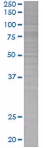 Ptgs2 293t cell transient overexpre ssion lysate (denatured) 100 µl