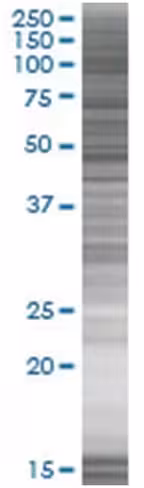 Ptpn1 293t cell transient overexpre ssion lysate (denatured) 100 µl