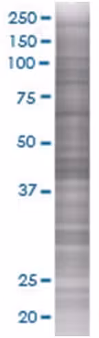 Ptpn7 293t cell transient overexpre ssion lysate (denatured) 100 µl