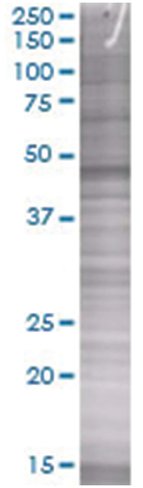 Ptpn11 293t cell transient overexpr ession lysate (denatured) 100 µl