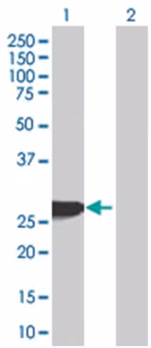 Rab27b 293t cell transient overexpr ession lysate (denatured) 100 µl