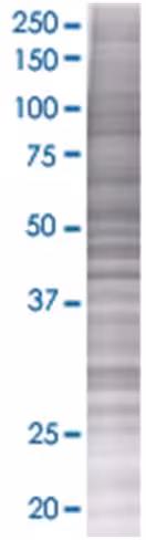 Rad23b 293t cell transient overexpr ession lysate (denatured) 100 µl