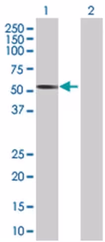 Rad23b 293t cell transient overexpr ession lysate (denatured) 100 µl