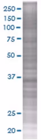 Rad51 293t cell transient overexpre ssion lysate (denatured) 100 µl