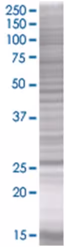 Ralb 293t cell transient overexpres sion lysate (denatured) 100 µl