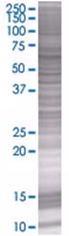 Rangap1 293t cell transient overexp ression lysate (denatured) 100 µl