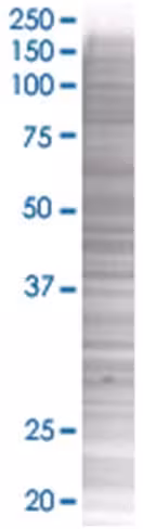 Rarg 293t cell transient overexpres sion lysate (denatured) 100 µl