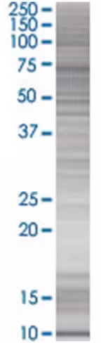 Rarres3 293t cell transient overexp ression lysate (denatured) 100 µl
