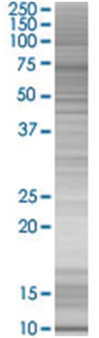Rarres3 293t cell transient overexp ression lysate (denatured) 100 µl