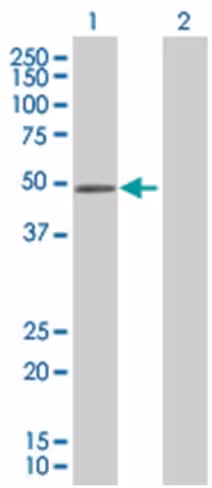 Rbms1 293t cell transient overexpre ssion lysate (denatured) 100 µl
