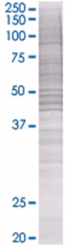 Rbms2 293t cell transient overexpre ssion lysate (denatured) 100 µl