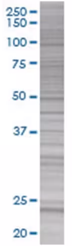 Rcv1 293t cell transient overexpres sion lysate (denatured) 100 µl