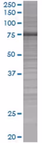 Rdx 293t cell transient overexpress ion lysate (denatured) 100 µl