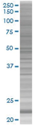 Prdx2 293t cell transient overexpre ssion lysate (denatured) 100 µl