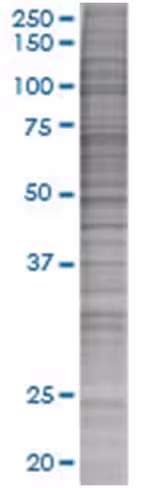 Psca 293t cell transient overexpres sion lysate (denatured) 100 µl