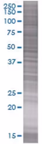 Prpf18 293t cell transient overexpr ession lysate (denatured) 100 µl