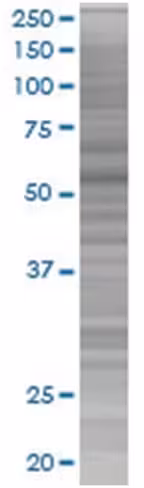 Pla2g4c 293t cell transient overexp ression lysate (denatured) 100 µl