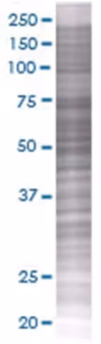 Pkmyt1 293t cell transient overexpr ession lysate (denatured) 100 µl