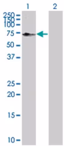 Pdcd8 293t cell transient overexpre ssion lysate (denatured) 100 µl
