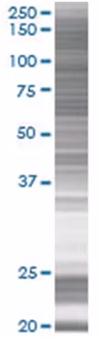 Pscd2 293t cell transient overexpre ssion lysate (denatured) 100 µl