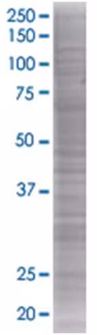 Rab33a 293t cell transient overexpr ession lysate (denatured) 100 µl