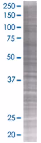Pick1 293t cell transient overexpre ssion lysate (denatured) 100 µl