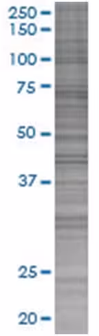 Polr1c 293t cell transient overexpr ession lysate (denatured) 100 µl