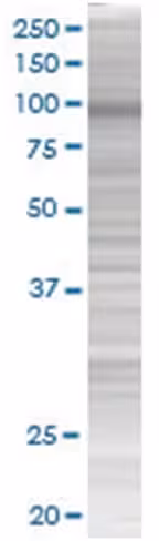 Phf16 293t cell transient overexpre ssion lysate (denatured) 100 µl