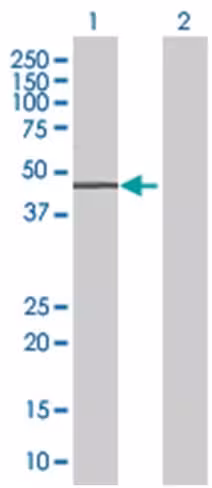 Rapgef5 293t cell transient overexp ression lysate (denatured) 100 µl