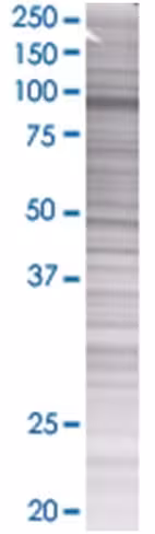 Pdcd6ip 293t cell transient overexp ression lysate (denatured) 100 µl