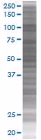 Rbm5 293t cell transient overexpres sion lysate (denatured) 100 µl