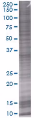 Psme3 293t cell transient overexpre ssion lysate (denatured) 100 µl