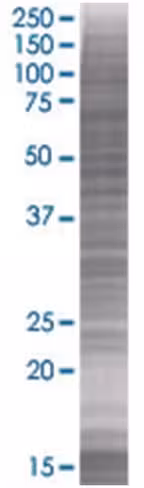 Ramp1 293t cell transient overexpre ssion lysate (denatured) 100 µl