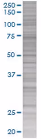 Procr 293t cell transient overexpre ssion lysate (denatured) 100 µl