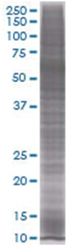 Pc4 293t cell transient overexpress ion lysate (denatured) 100 µl